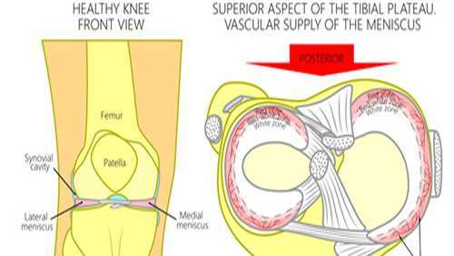 Meniscus Injury